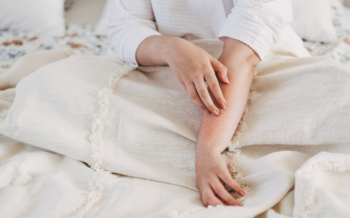 This Eczema Drug Just Got an FDA-Approved Upgrade