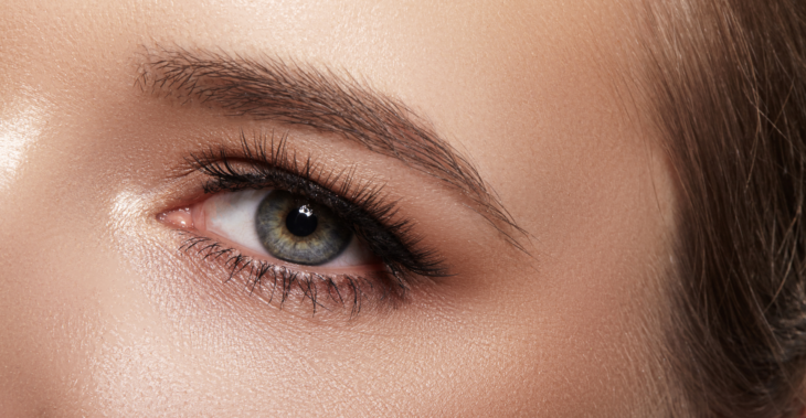 When Under-Eye Bags Aren't Actually Under-Eye Bags