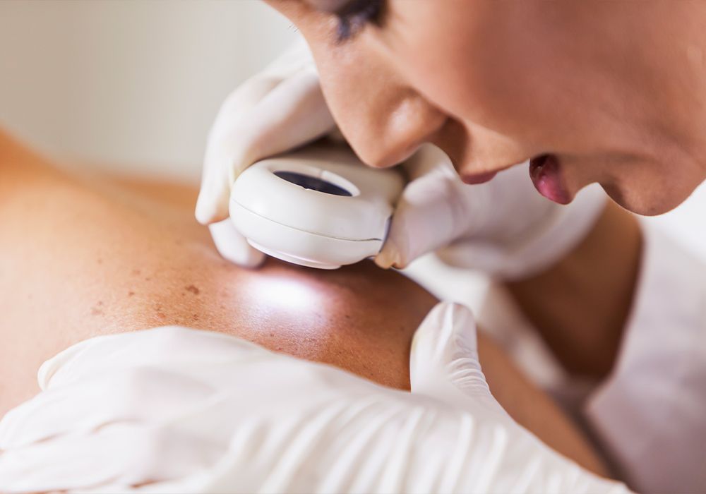 What Skin Cancer Can Really Look Like