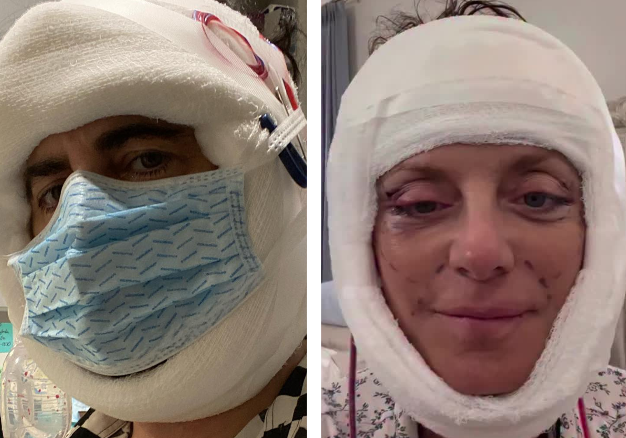 7 Celebrities Who Got Candid About Their Post-Procedure Recovery and Results
