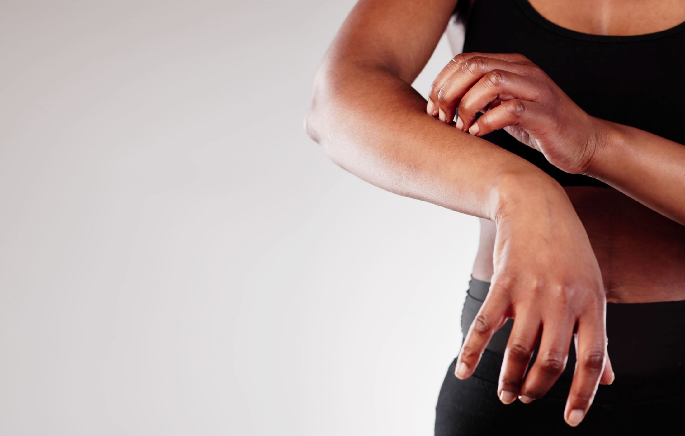 What Dermatologists Want Psoriasis Patients on GLP-1s to Know