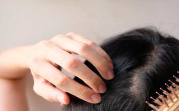 <![CDATA[Dandruff or Skin Cancer? How to Tell the Difference on Your Scalp]]>