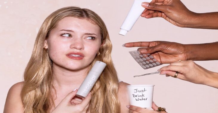 Isotretinoin, But Make It Topical: This Accutane Alternative Just Made Acne Care More Accessible