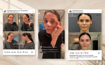 The Facelift Is No Longer Just a Later-in-Life Procedure