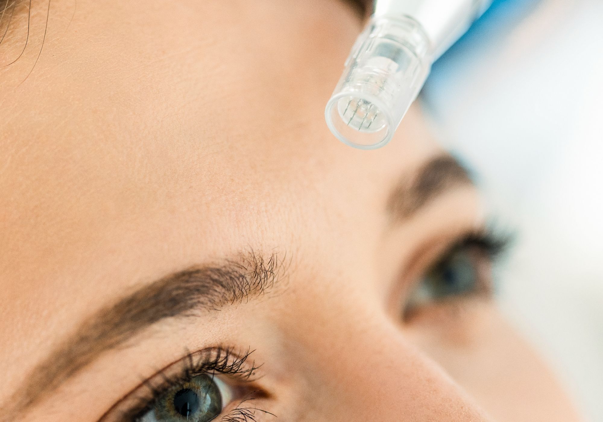 10 Celebrities Who Love Microneedling