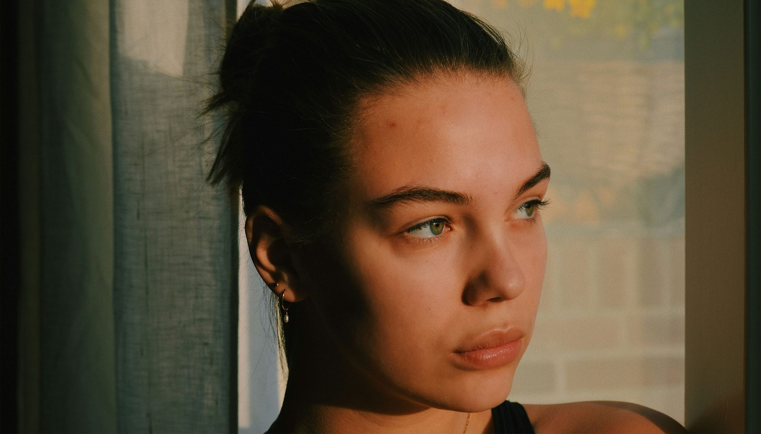 Have Psoriasis? Here’s What You Need to Know Before Your Next Cosmetic Treatment