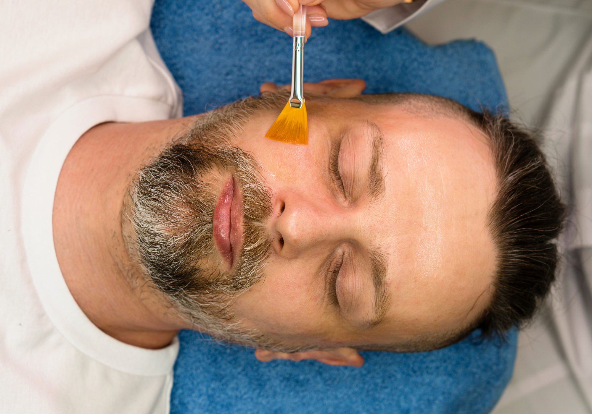 A TikToker's At-Home 30 Percent TCA Peel Has 25 Million Views—and Doctors Are Worried