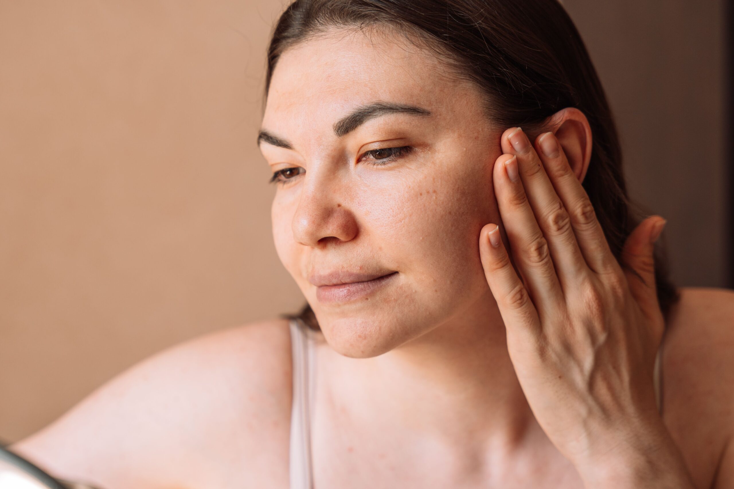Acne Is More Than the Breakout—Here’s How to Treat It at Every Stage