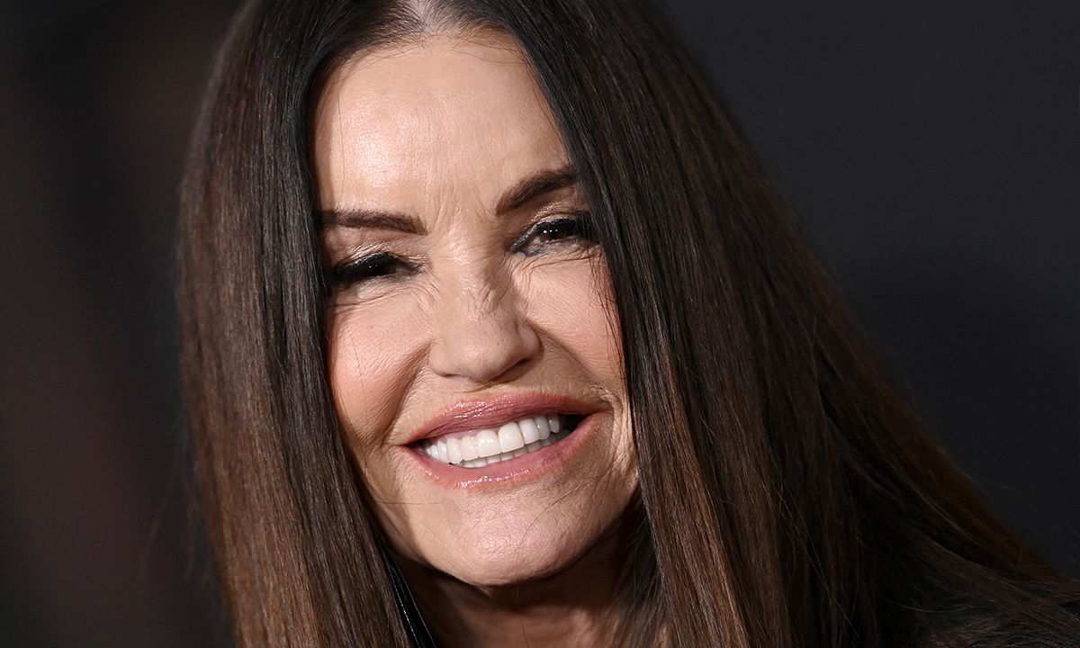 Janice Dickinson Reveals Deep Plane Facelift and Brow Lift Results at 71