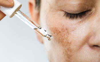 A Deep Dive Into the Frustrating World of Dark Spots