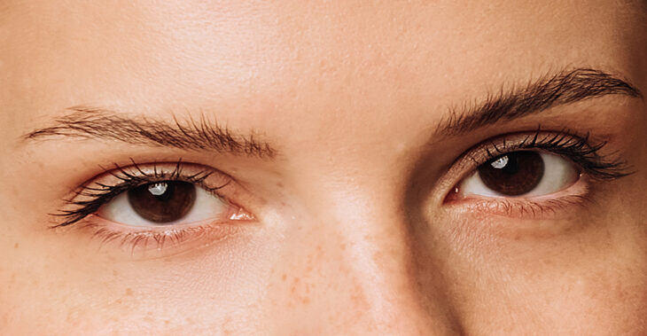 This Viral Lower Blepharoplasty Has TikTok Asking Questions
