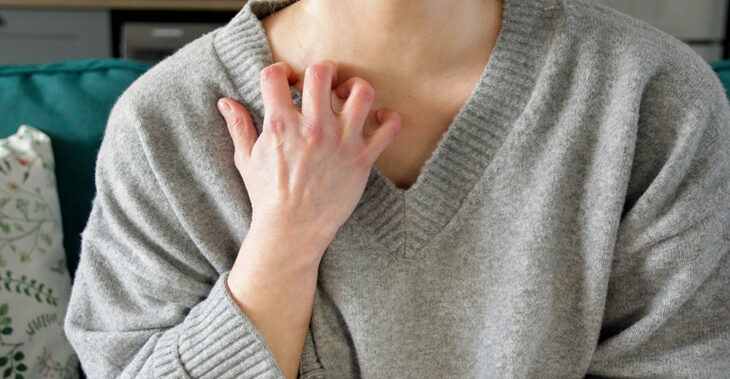 Why Dermatologists Are Looking at GLP-1s for Psoriasis