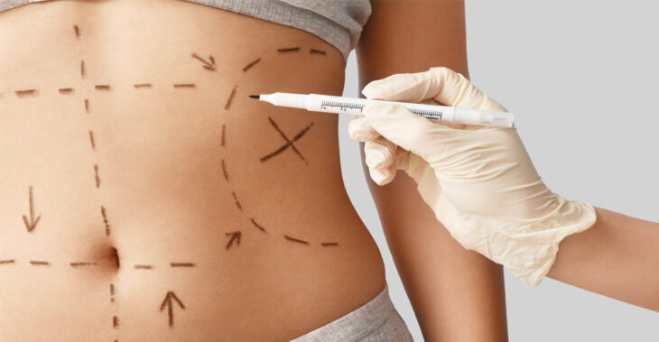 The Cosmetic Surgeries That Can Be Covered by Insurance
