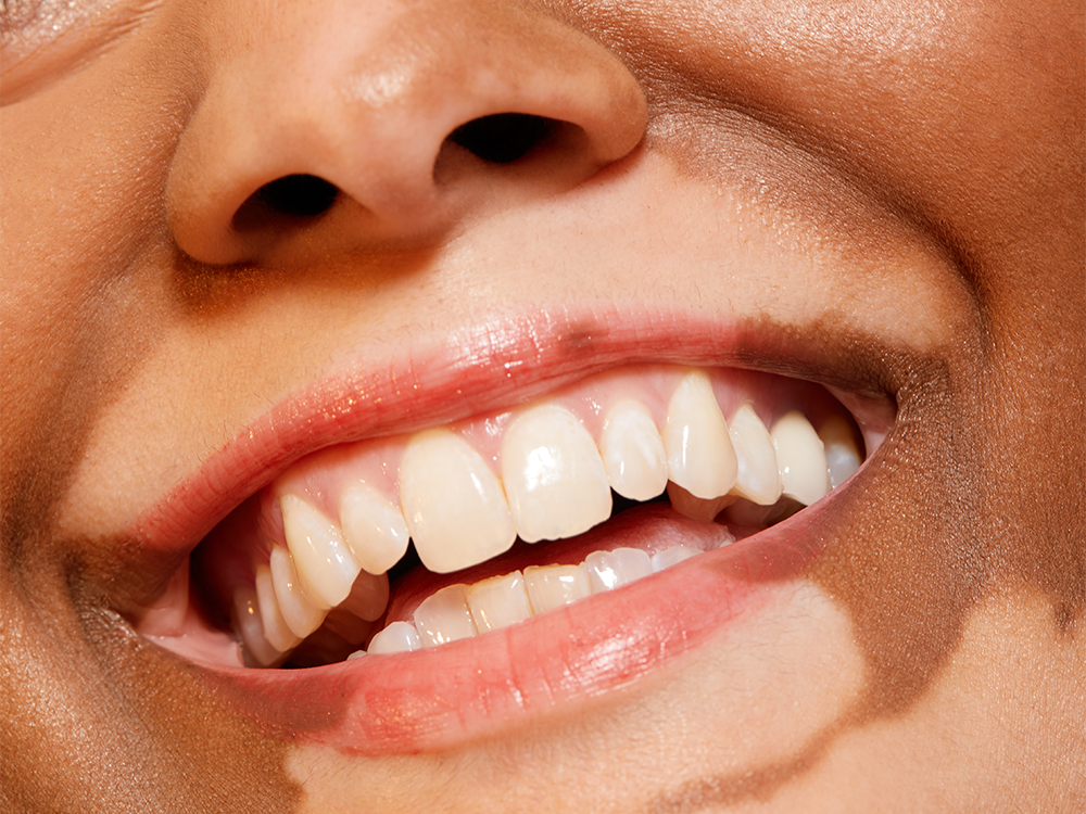 Garlic Mouthwash Isn’t as Far-Fetched as You’d Think